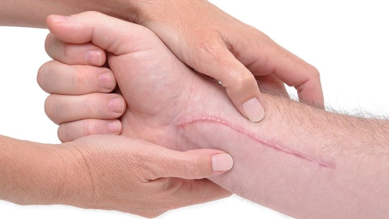 Narbe_NEW_WEB_800_450